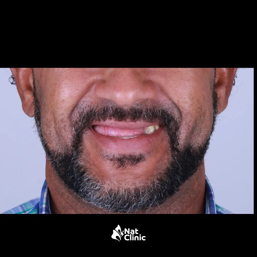 Transformación integral - Antes